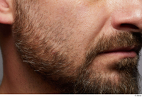  HD Face Skin Neeo bearded cheek chin face lips mouth nose skin pores skin texture 0001.jpg